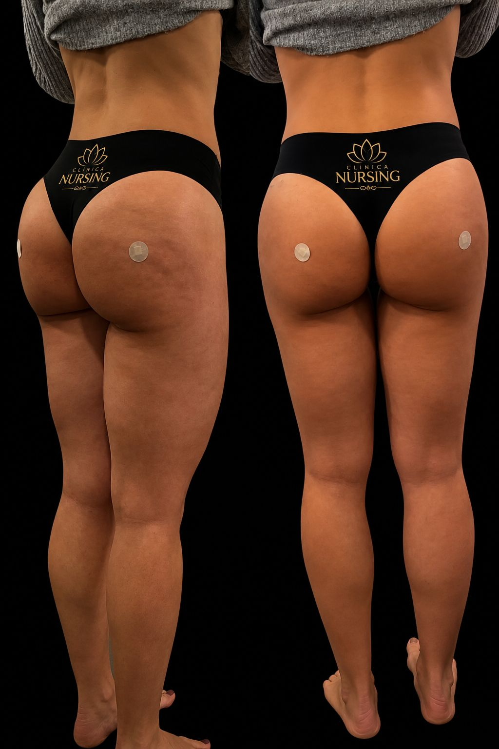Registro de resultado corporal antes e depois